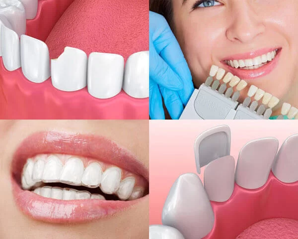 Cosmetic Dentist odessa