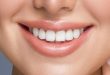 How Dental Veneers Can Enhance Your Confidence and Change Your Life