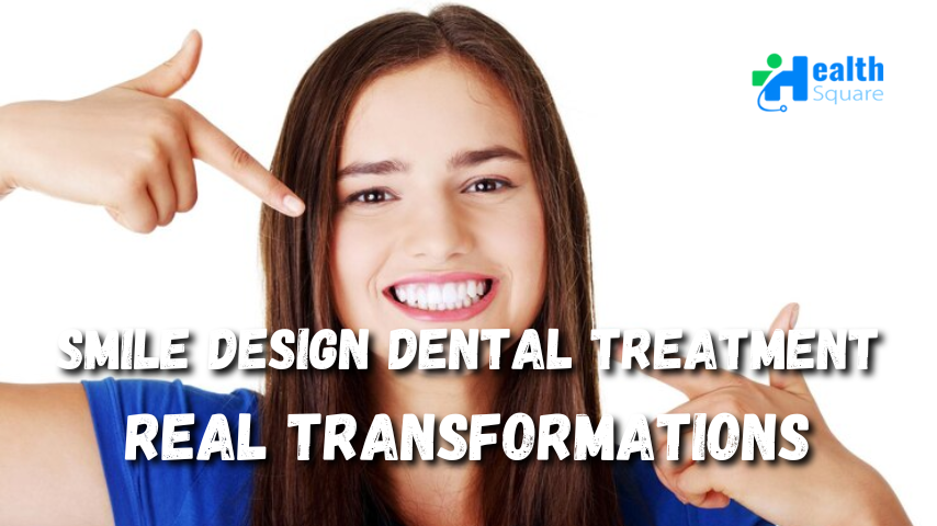 Smile Design Dental Treatment
